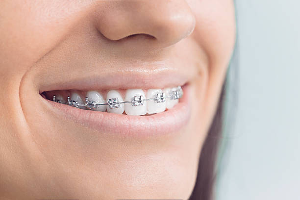 Best Veneers and Lumineers  in Vista Santa Rosa, CA